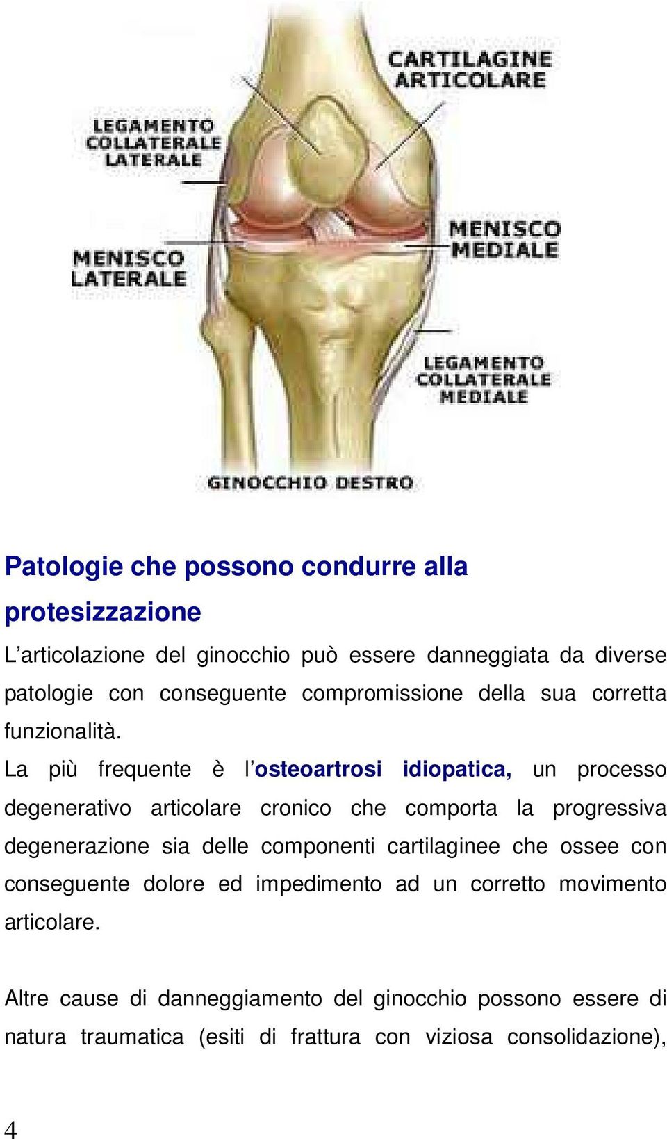 La più frequente è l osteoartrosi idiopatica, un processo degenerativo articolare cronico che comporta la progressiva degenerazione sia delle