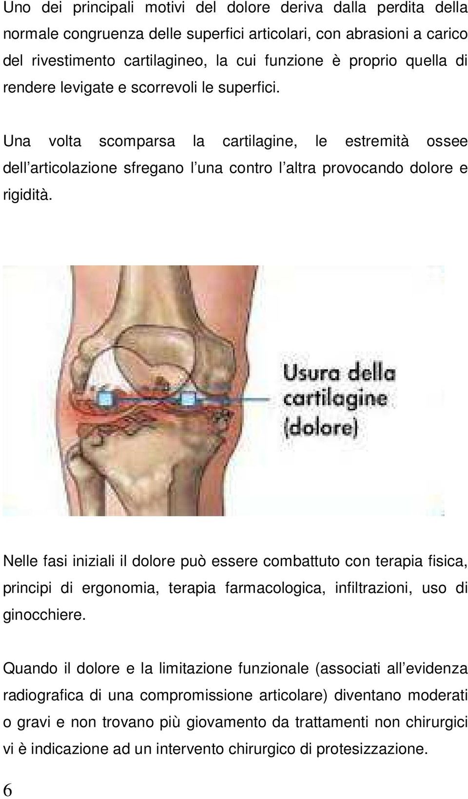 Nelle fasi iniziali il dolore può essere combattuto con terapia fisica, principi di ergonomia, terapia farmacologica, infiltrazioni, uso di ginocchiere.