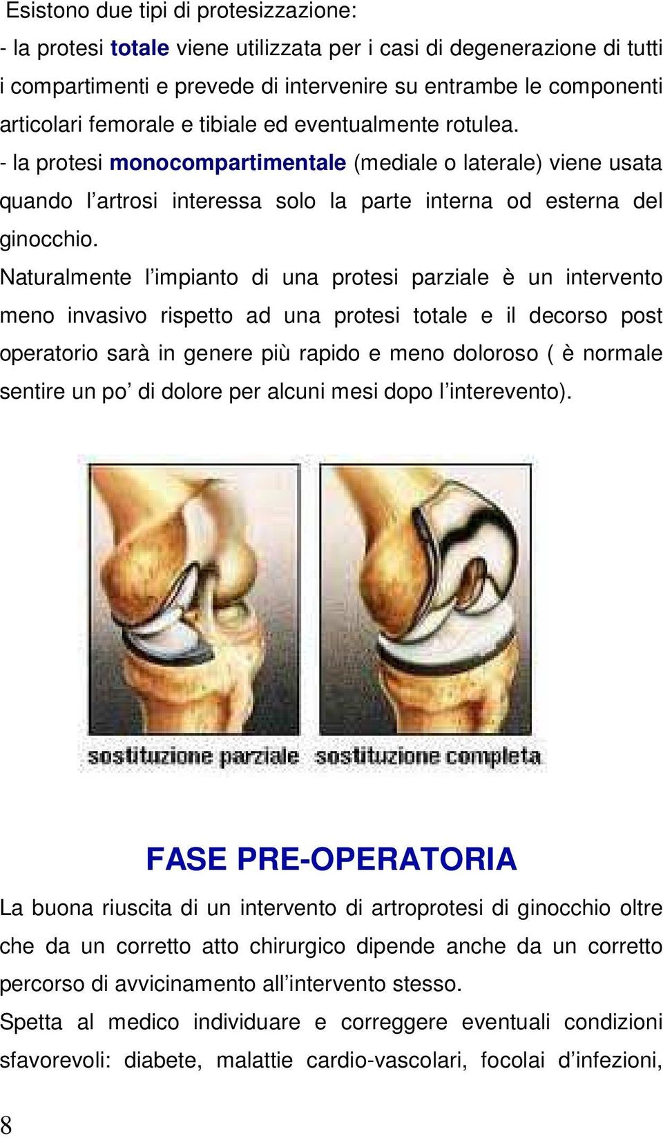 Naturalmente l impianto di una protesi parziale è un intervento meno invasivo rispetto ad una protesi totale e il decorso post operatorio sarà in genere più rapido e meno doloroso ( è normale sentire