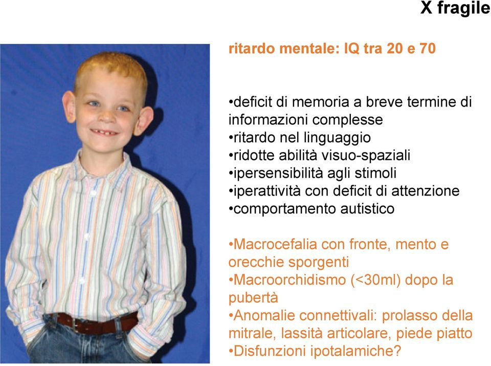 attenzione comportamento autistico Macrocefalia con fronte, mento e orecchie sporgenti Macroorchidismo (<30ml)