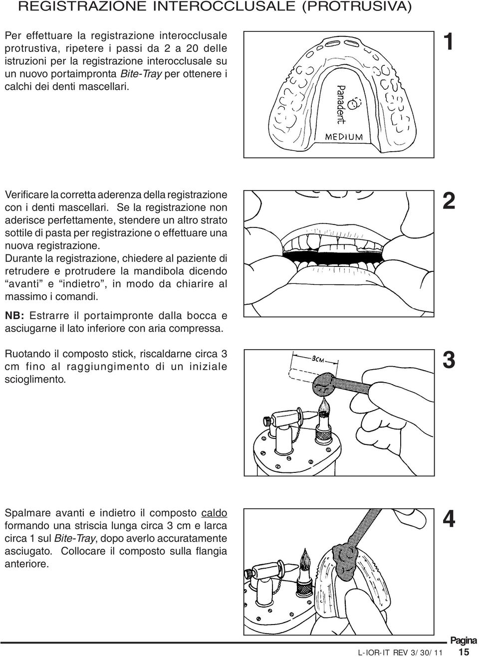 Se la registrazione non aderisce perfettamente, stendere un altro strato sottile di pasta per registrazione o effettuare una nuova registrazione.