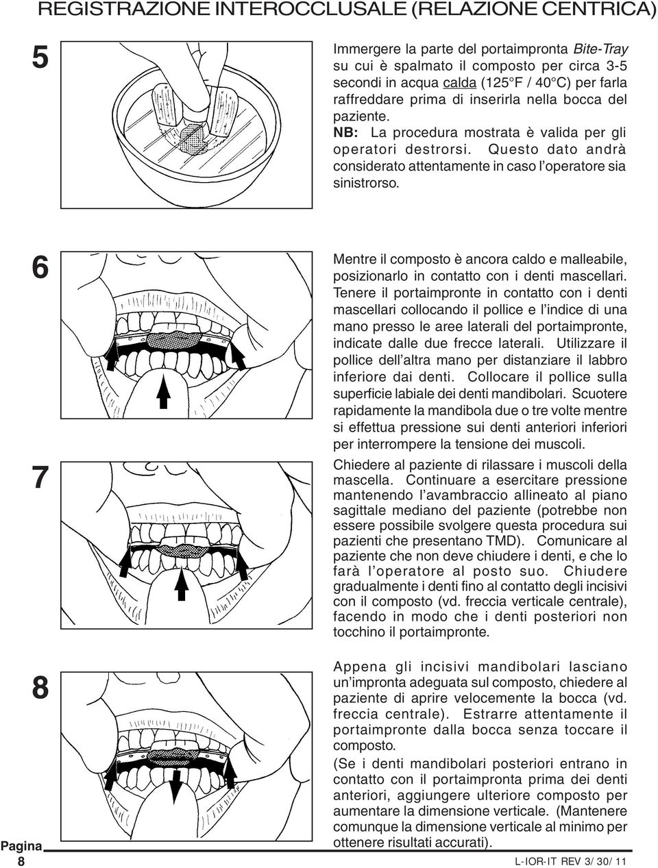 6 7 8 8 Mentre il composto è ancora caldo e malleabile, posizionarlo in contatto con i denti mascellari.