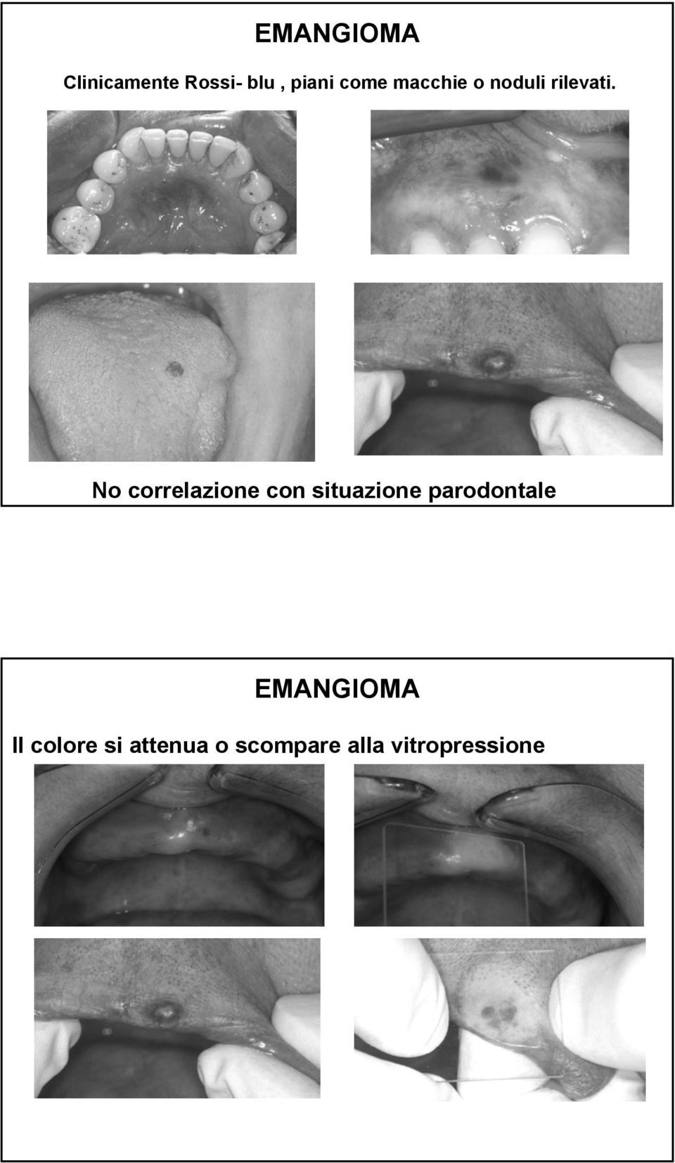 No correlazione con situazione parodontale