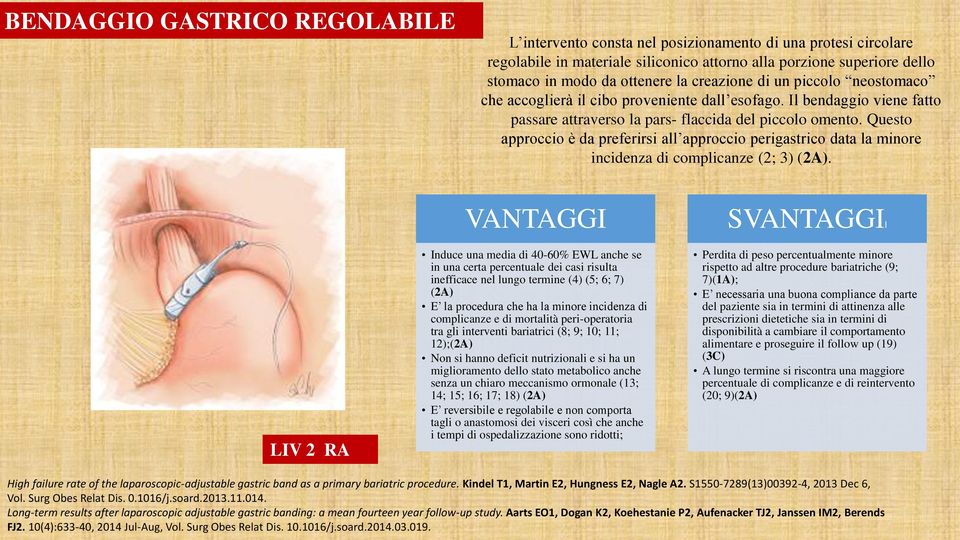 Questo approccio è da preferirsi all approccio perigastrico data la minore incidenza di complicanze (2; 3) (2A).