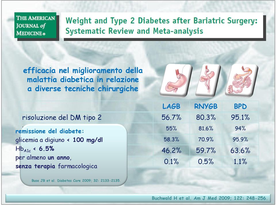 1% remissione del diabete: risoluzione del DM<tipo 2 anni glicemia a digiuno 1002 mg/dl Hbentità A1c < 6.