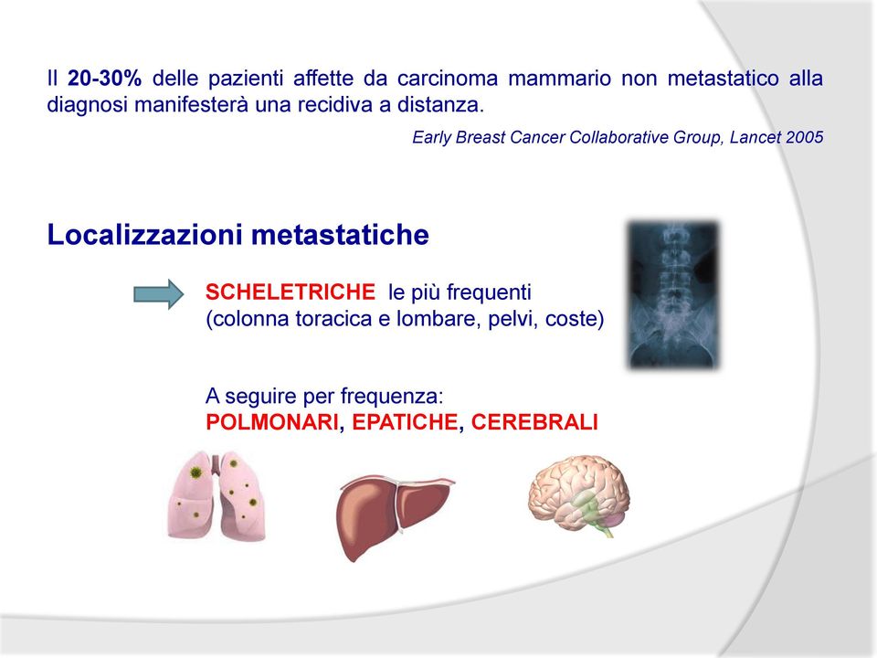 Early Breast Cancer Collaborative Group, Lancet 2005 Localizzazioni metastatiche