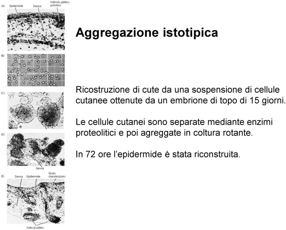 Le cellule cutanei sono separate mediante enzimi proteolitici e poi