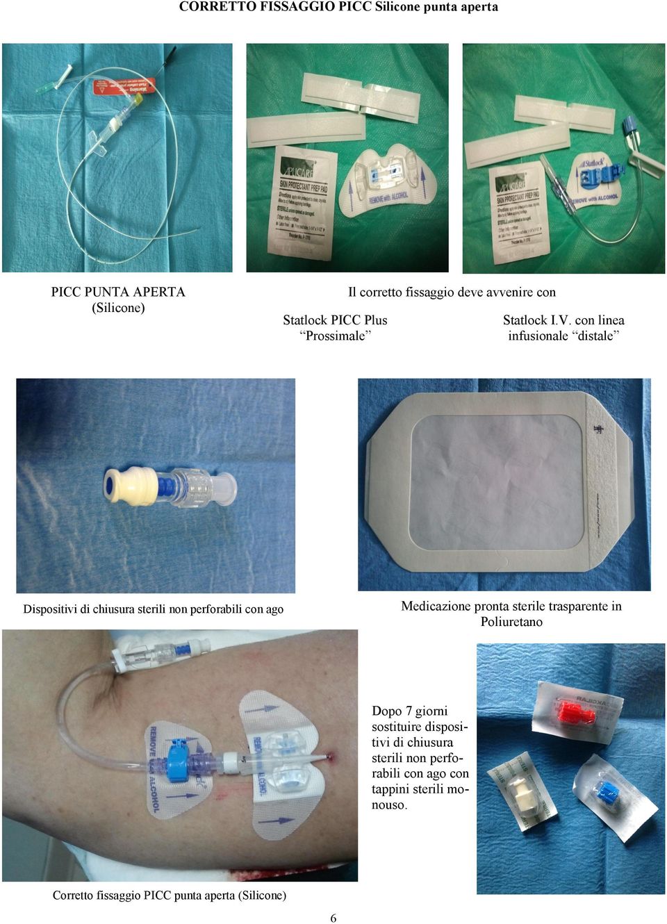 con linea infusionale distale Medicazione pronta sterile trasparente in Poliuretano Dispositivi di chiusura