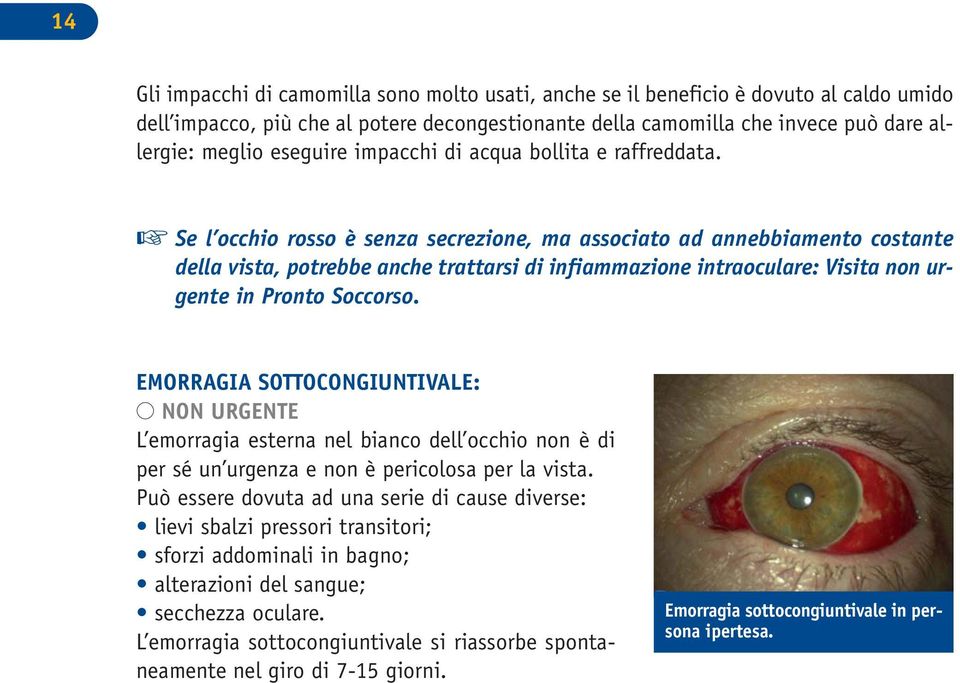 Se l occhio rosso è senza secrezione, ma associato ad annebbiamento costante della vista, potrebbe anche trattarsi di infiammazione intraoculare: Visita non urgente in Pronto Soccorso.