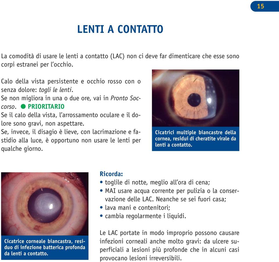 PRIORITARIO Se il calo della vista, l arrossamento oculare e il dolore sono gravi, non aspettare.