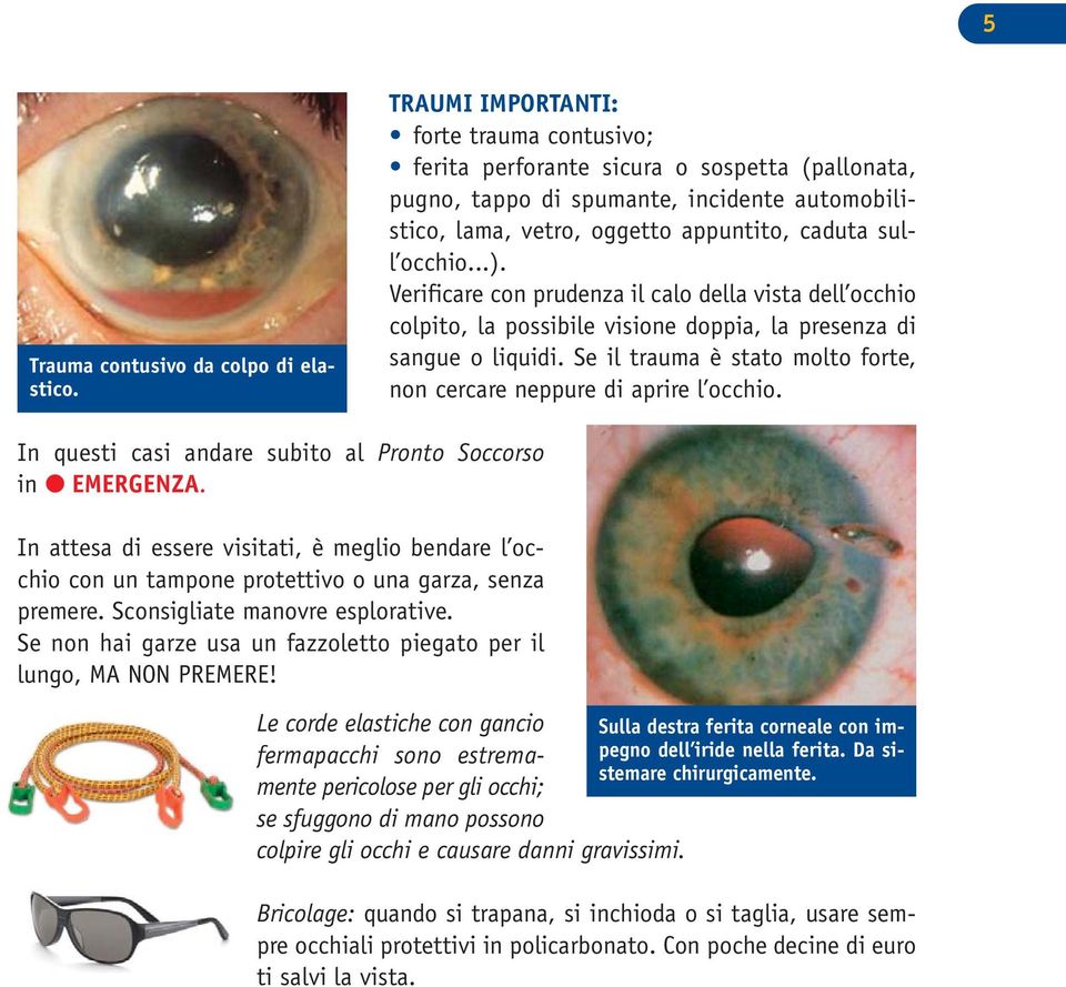 Verificare con prudenza il calo della vista dell occhio colpito, la possibile visione doppia, la presenza di sangue o liquidi. Se il trauma è stato molto forte, non cercare neppure di aprire l occhio.