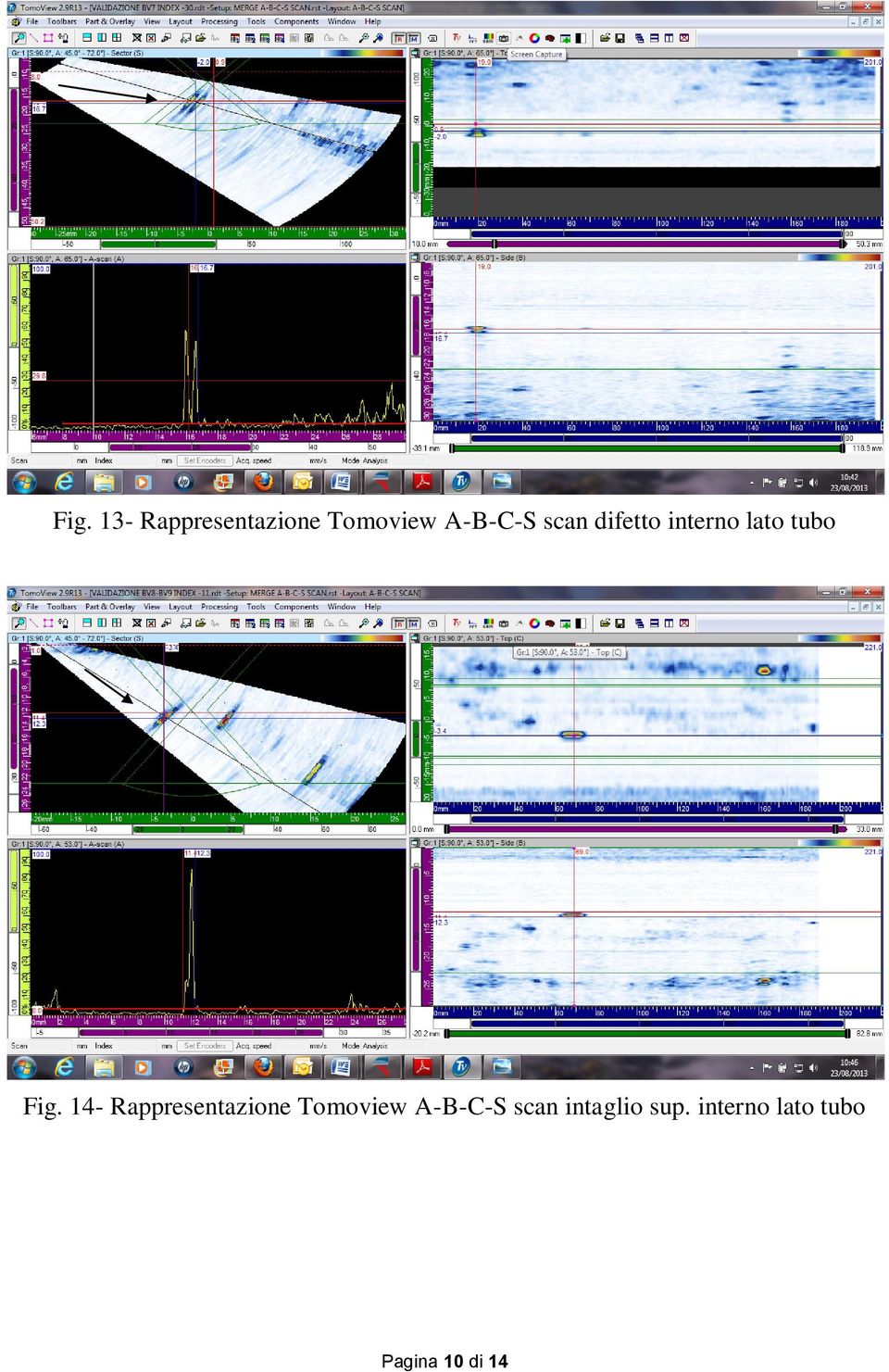 14- Rappresentazione Tomoview A-B-C-S scan