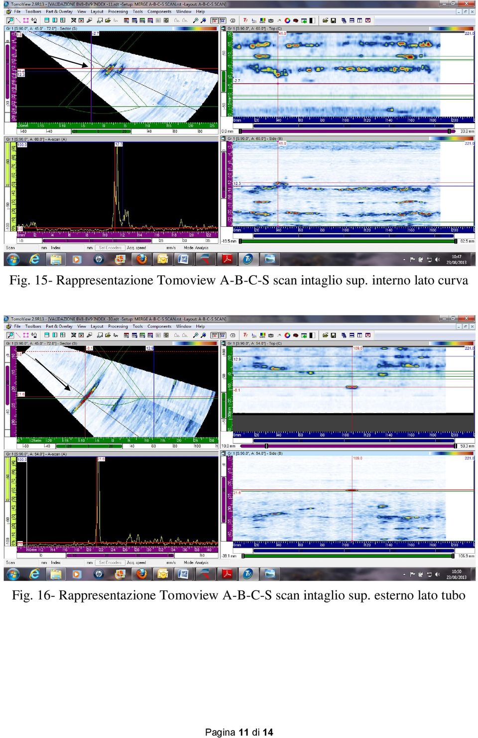 16- Rappresentazione Tomoview A-B-C-S scan