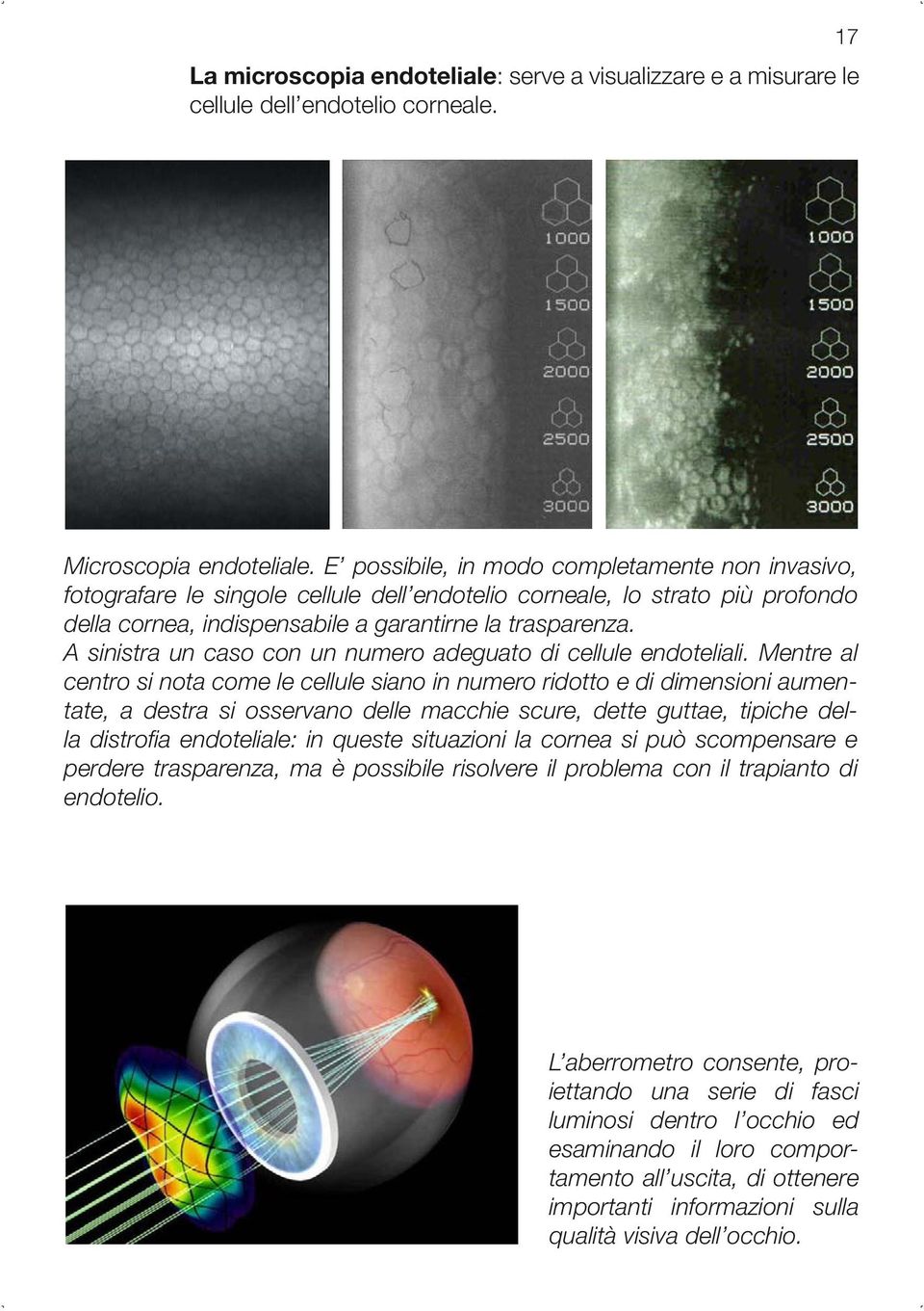 A sinistra un caso con un numero adeguato di cellule endoteliali.