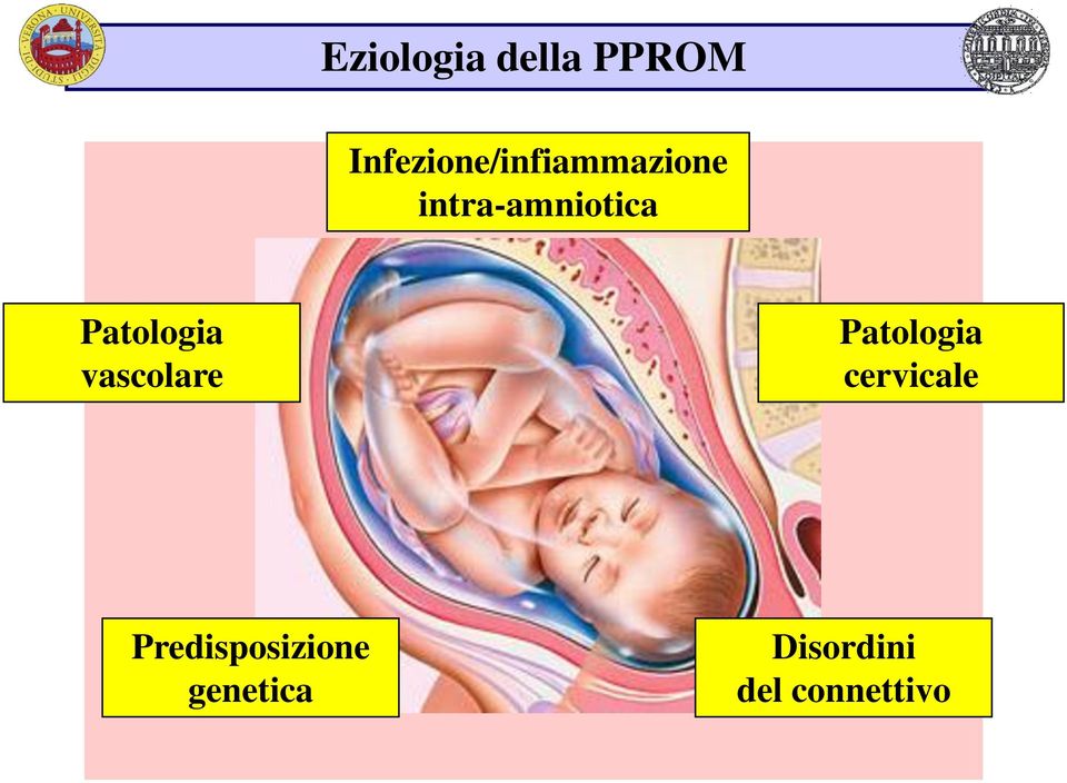 intra-amniotica Patologia vascolare