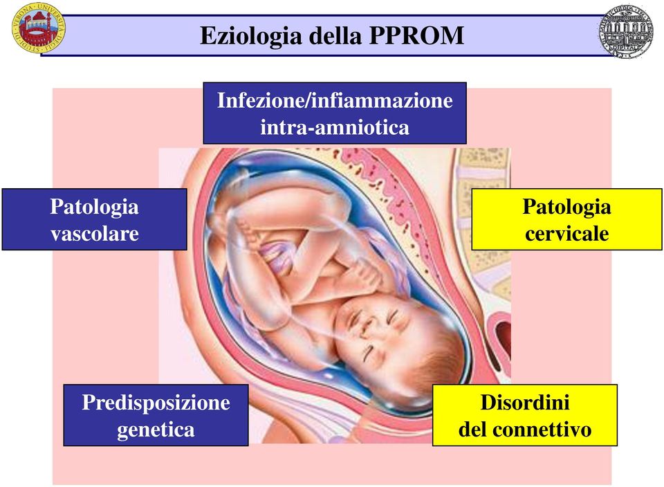 intra-amniotica Patologia vascolare