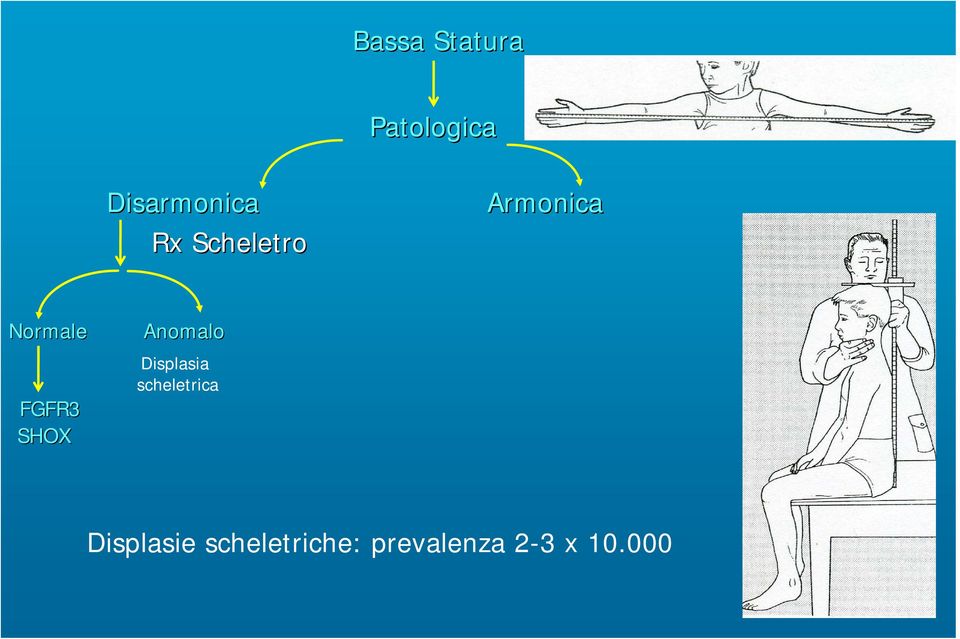 SHOX Anomalo Displasia scheletrica