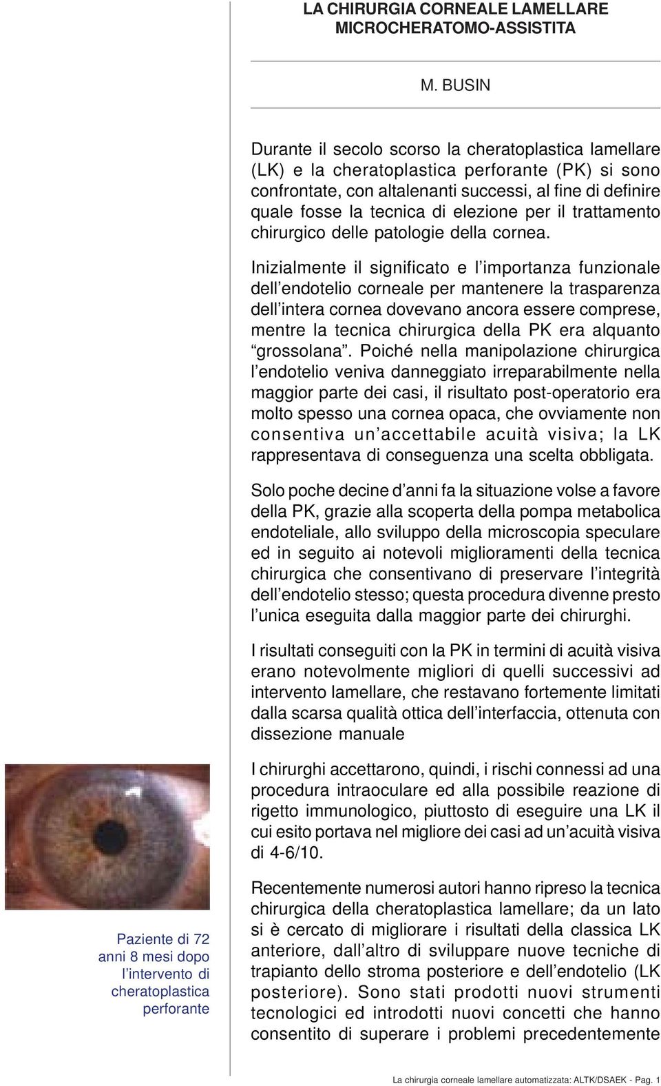 elezione per il trattamento chirurgico delle patologie della cornea.