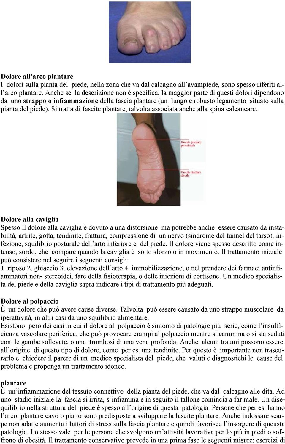 Si tratta di fascite plantare, talvolta associata anche alla spina calcaneare.