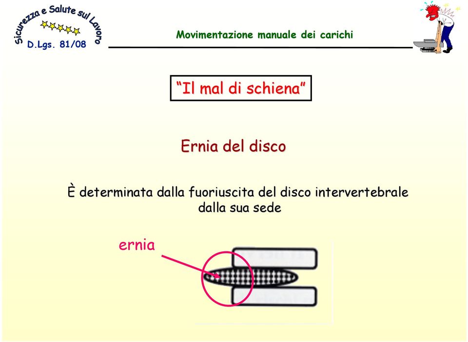 fuoriuscita del disco