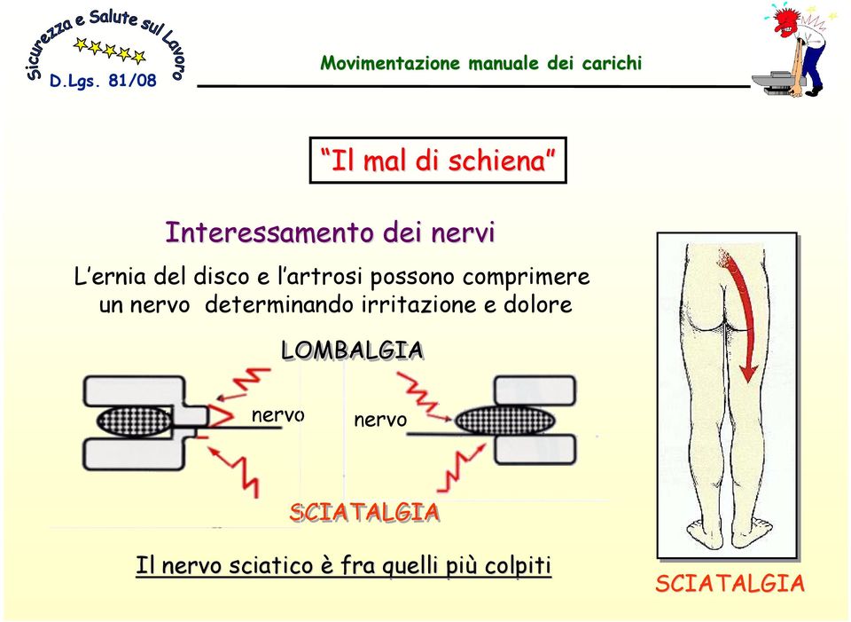 determinando irritazione e dolore LOMBALGIA nervo nervo