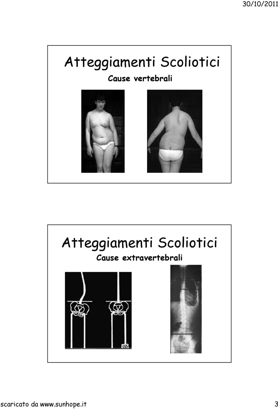 extravertebrali scaricato da