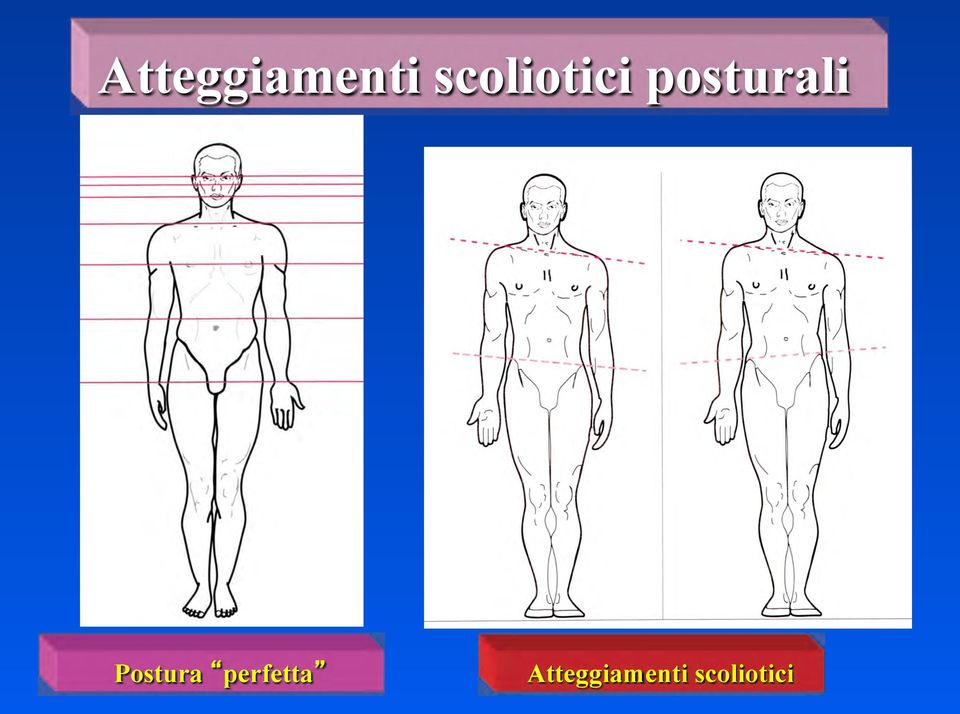 posturali Postura