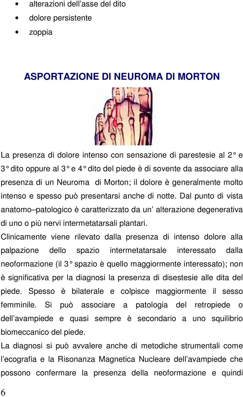 Dal punto di vista anatomo patologico è caratterizzato da un alterazione degenerativa di uno o più nervi intermetatarsali plantari.