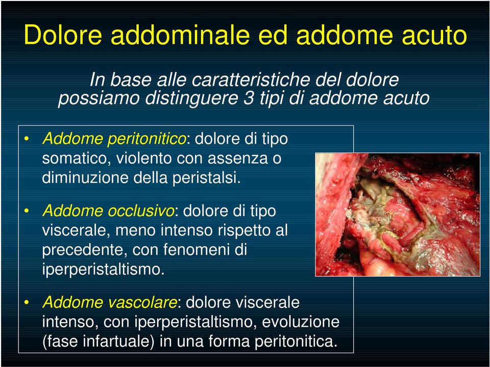 Addome occlusivo: dolore di tipo viscerale, meno intenso rispetto al precedente, con fenomeni di