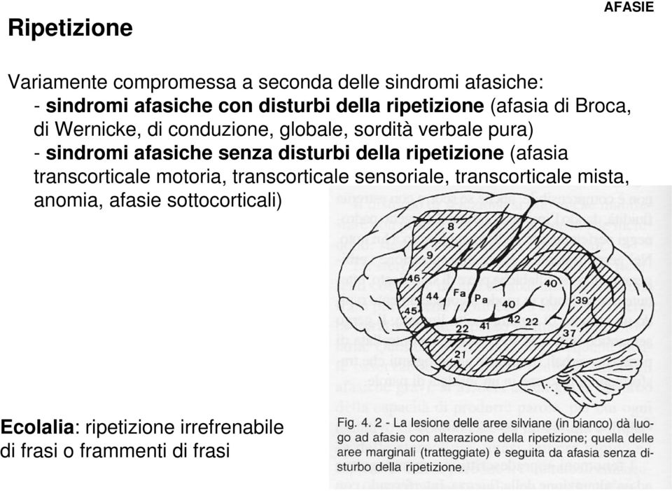 sindromi afasiche senza disturbi della ripetizione (afasia transcorticale motoria, transcorticale