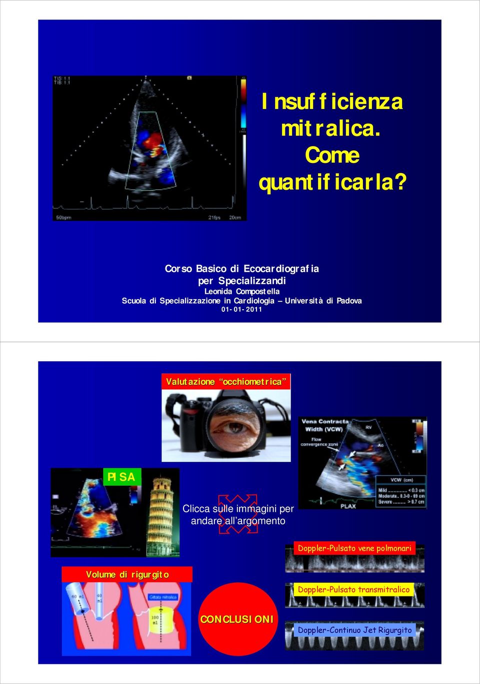 in Cardiologia Università di Padova 01-01-2011 Valutazione occhiometrica PISA Clicca sulle