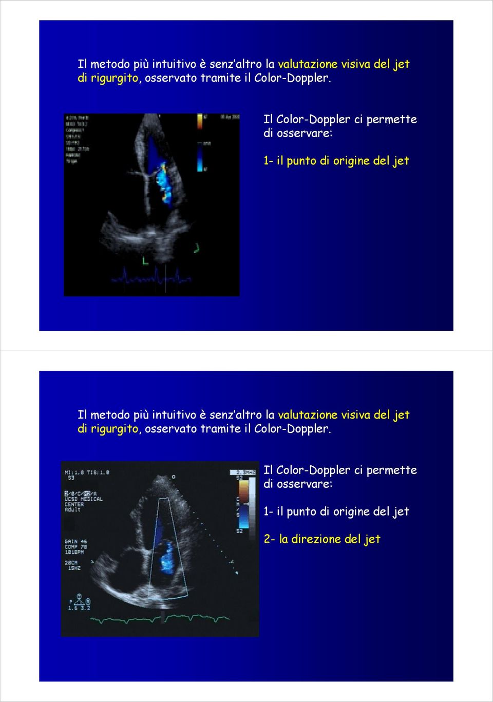 Il Color-Doppler ci permette di osservare: 1- il punto di origine del jet   Il Color-Doppler ci