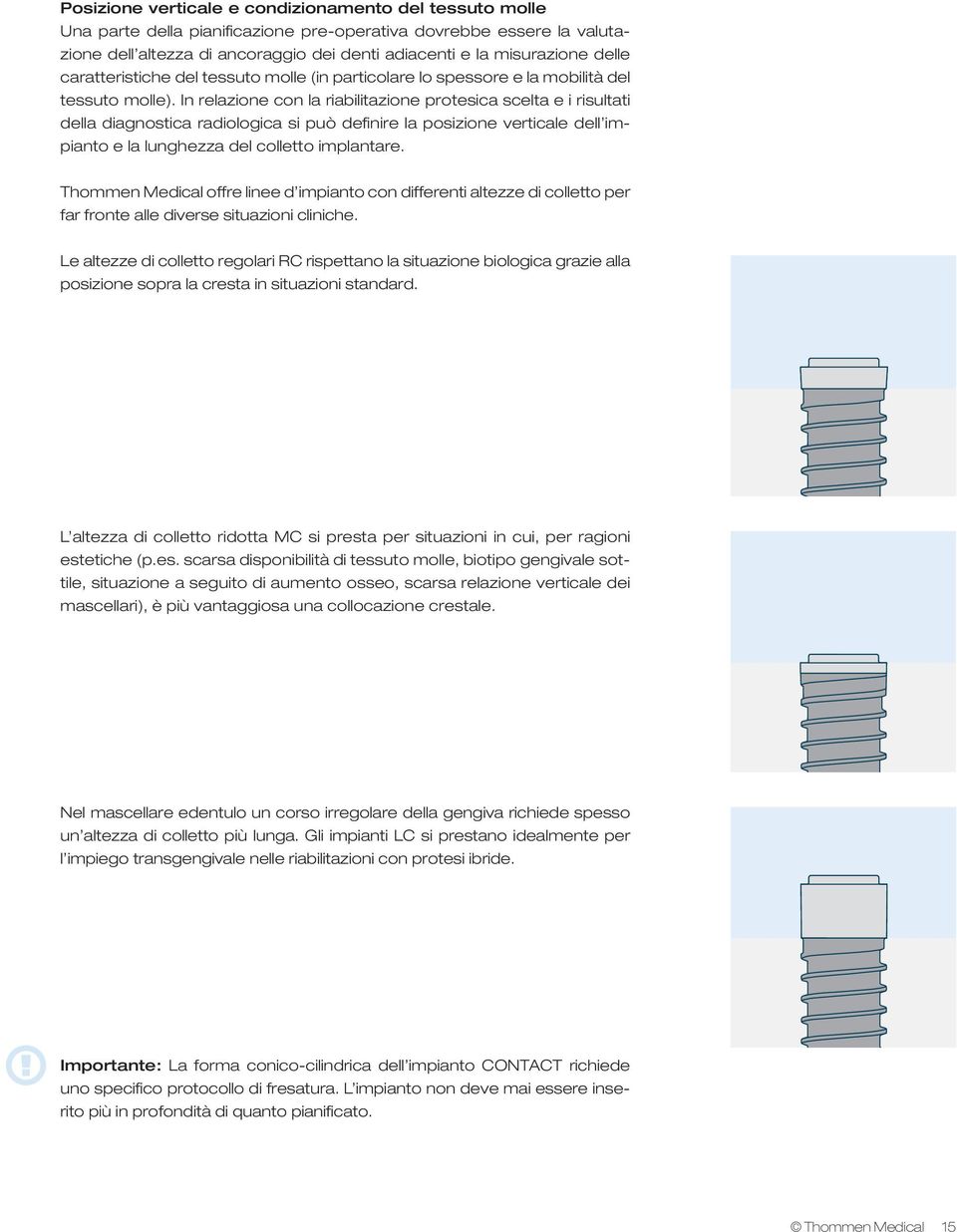 In relazione con la riabilitazione protesica scelta e i risultati della diagnostica radiologica si può definire la posizione verticale dell impianto e la lunghezza del colletto implantare.