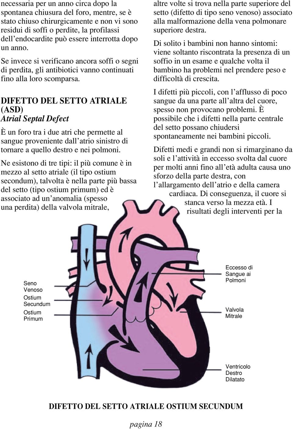 DIFETTO DEL SETTO ATRIALE (ASD) Atrial Septal Defect È un foro tra i due atri che permette al sangue proveniente dall atrio sinistro di tornare a quello destro e nei polmoni.