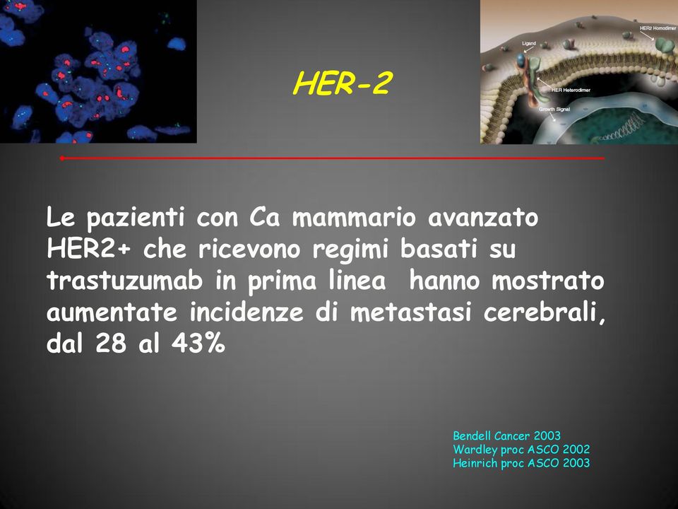 aumentate incidenze di metastasi cerebrali, dal 28 al 43%