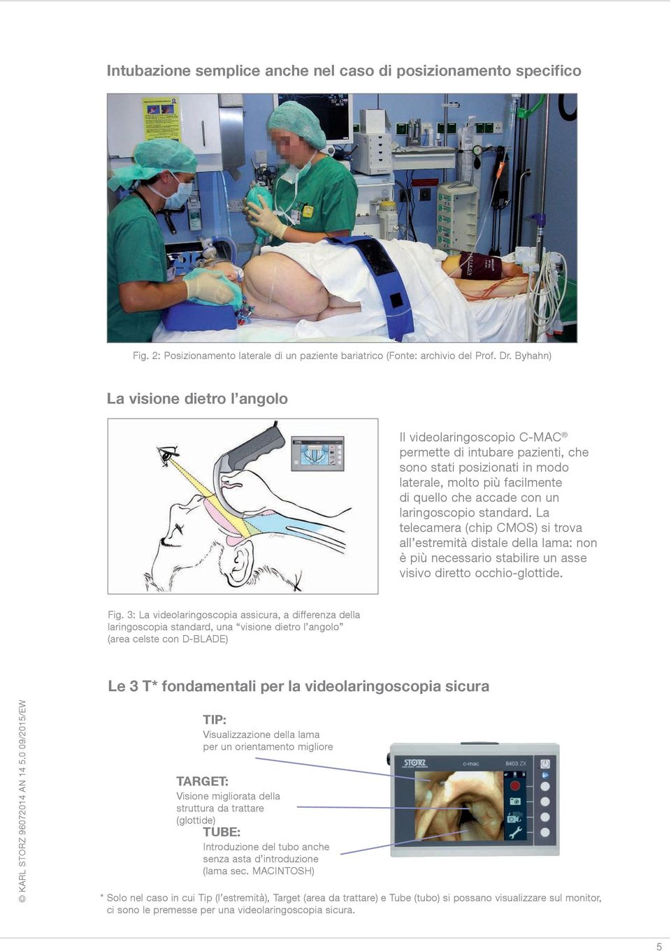 laringoscopio standard. La telecamera (chip CMOS) si trova all estremità distale della lama: non è più necessario stabilire un asse visivo diretto occhio-glottide. Fig.