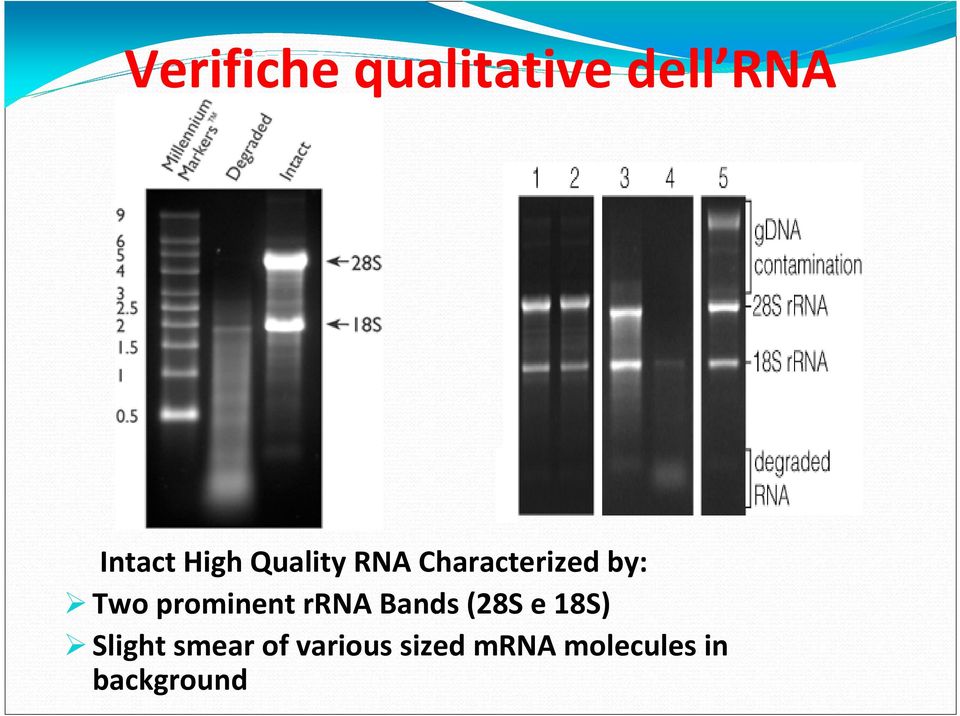 rrna Bands (28S e 18S) Slight