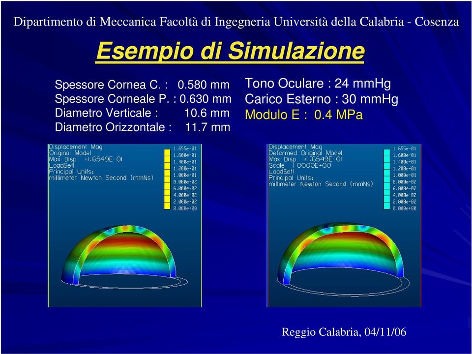 580 mm Spessore Corneale P. : 0.630 mm Diametro Verticale : 10.