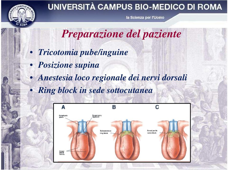 supina Anestesia loco regionale dei