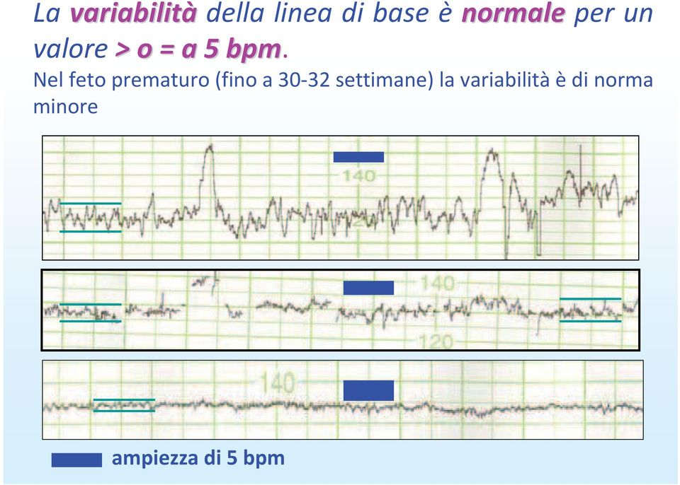 Nel feto prematuro (fino a 30 32