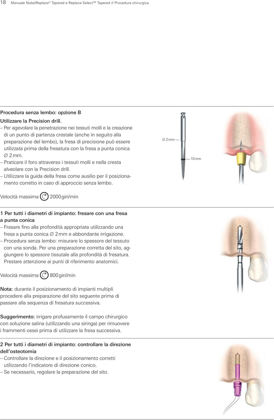 della fresatura con la fresa a punta conica 2 mm. Praticare il foro attraverso i tessuti molli e nella cresta alveolare con la Precision drill.