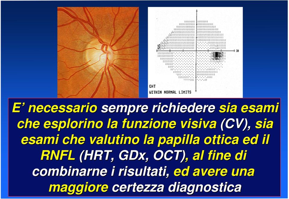 papilla ottica ed il RNFL (HRT, GDx,, OCT),, al fine di