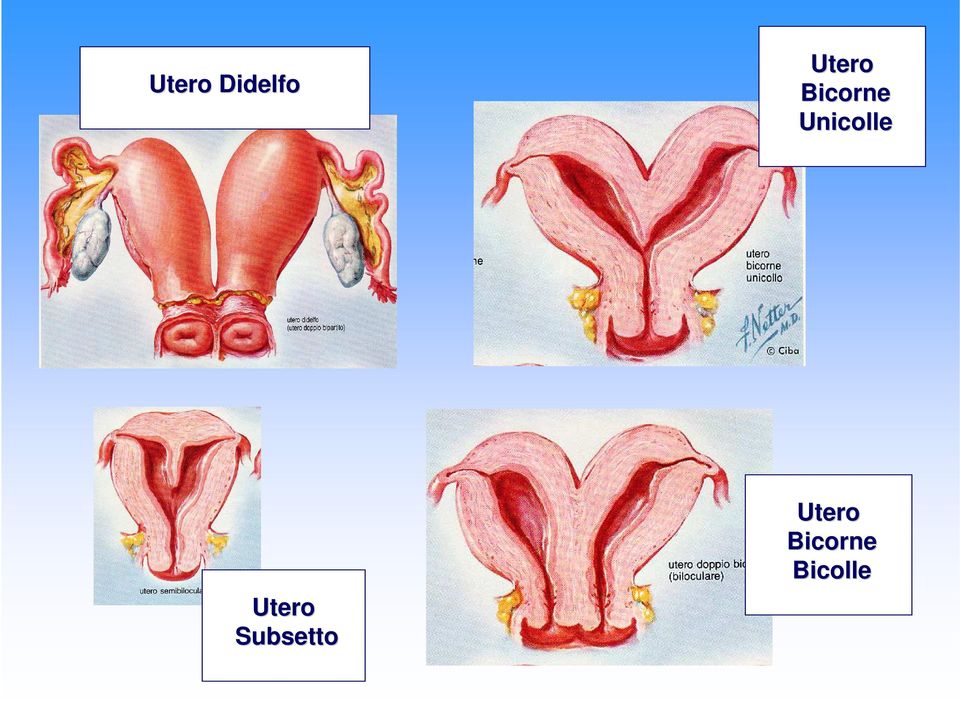 Unicolle Utero