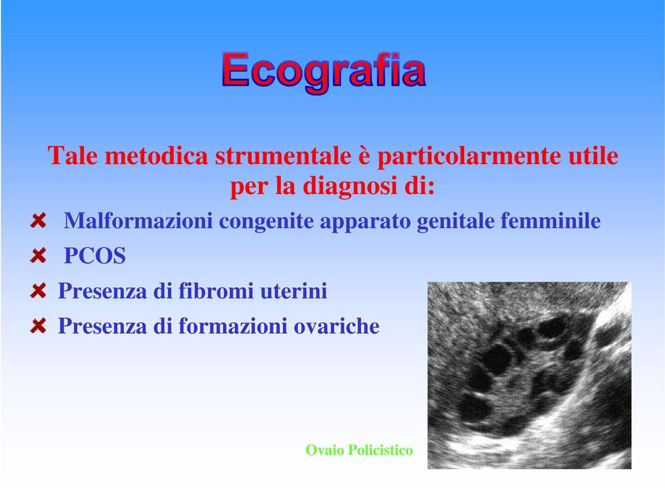 apparato genitale femminile PCOS Presenza di