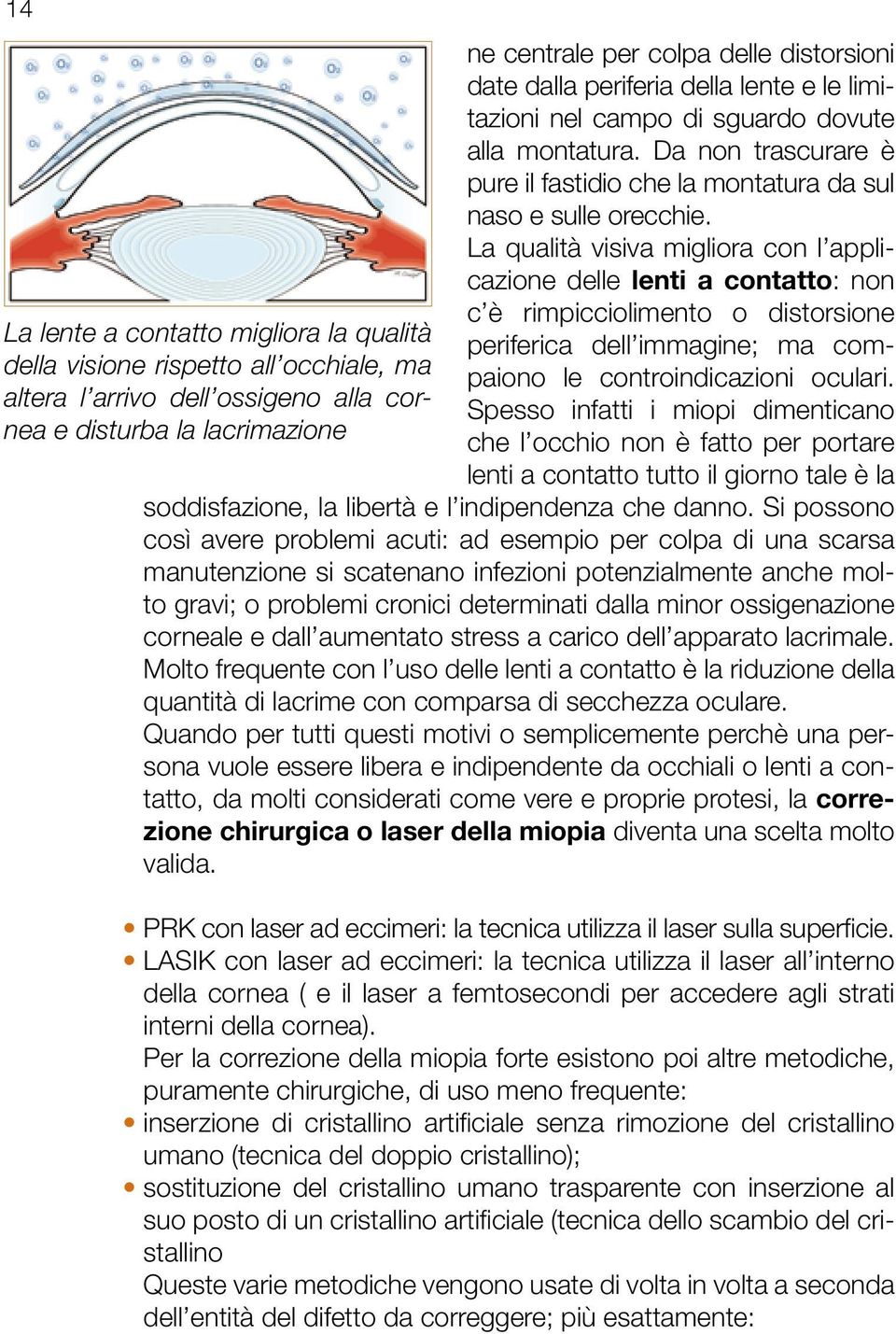 La qualità visiva migliora con l applicazione delle lenti a contatto: non c è rimpicciolimento o distorsione La lente a contatto migliora la qualità periferica dell immagine; ma compaiono le