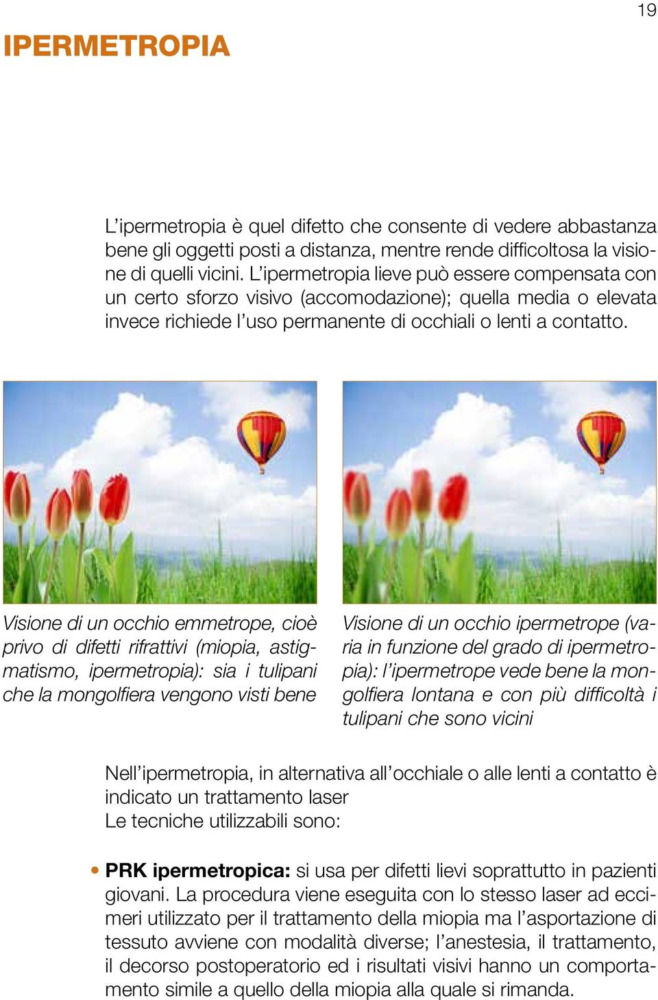 Visione di un occhio emmetrope, cioè privo di difetti rifrattivi (miopia, astigmatismo, ipermetropia): sia i tulipani che la mongolfiera vengono visti bene Visione di un occhio ipermetrope (varia in