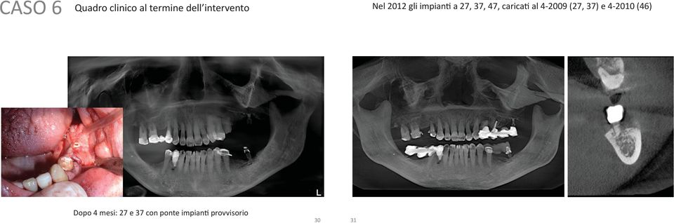 47, caricati al 4-2009 (27, 37) e 4-2010 (46)