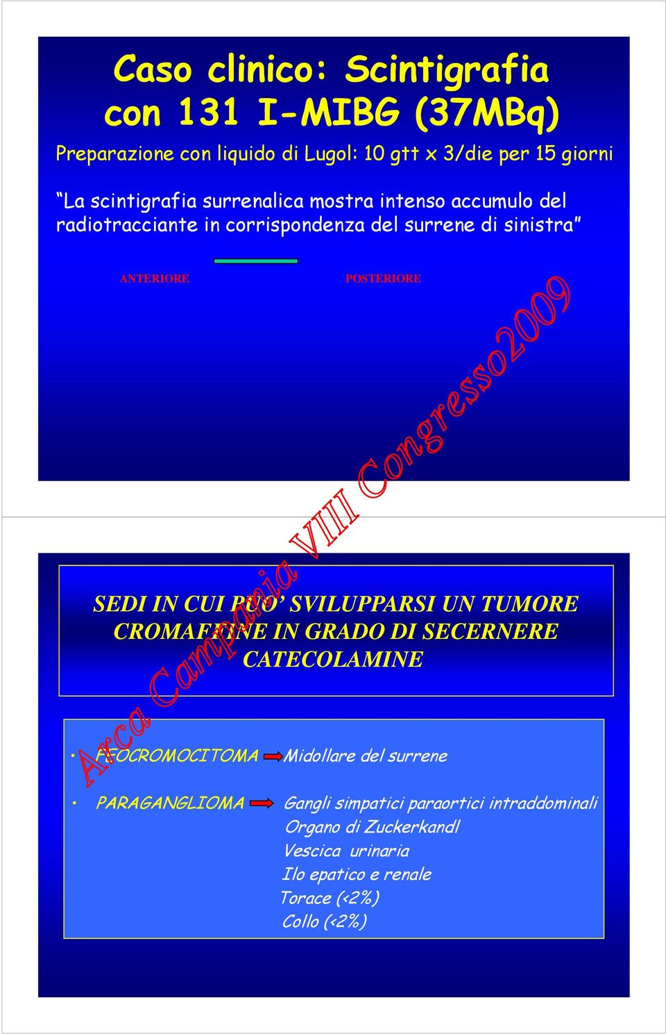 POSTERIORE SEDI IN CUI PUO SVILUPPARSI UN TUMORE CROMAFFINE IN GRADO DI SECERNERE CATECOLAMINE FEOCROMOCITOMA PARAGANGLIOMA