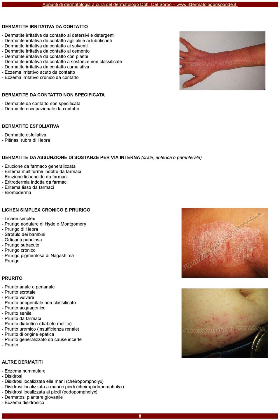 cumulativa - Eczema irritativo acuto da contatto - Eczema irritativo cronico da contatto DERMATITE DA CONTATTO NON SPECIFICATA - Dermatite da contatto non specificata - Dermatite occupazionale da