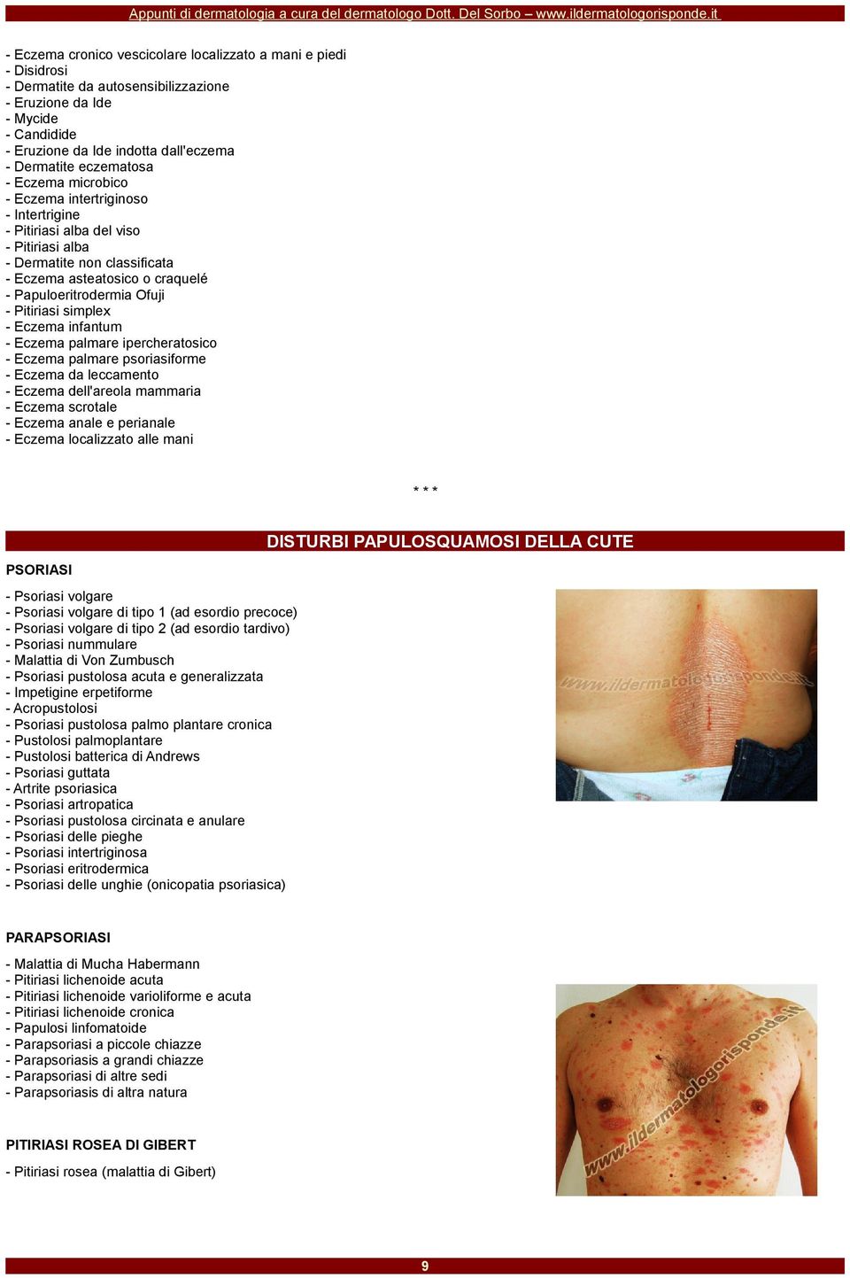 - Pitiriasi simplex - Eczema infantum - Eczema palmare ipercheratosico - Eczema palmare psoriasiforme - Eczema da leccamento - Eczema dell'areola mammaria - Eczema scrotale - Eczema anale e perianale